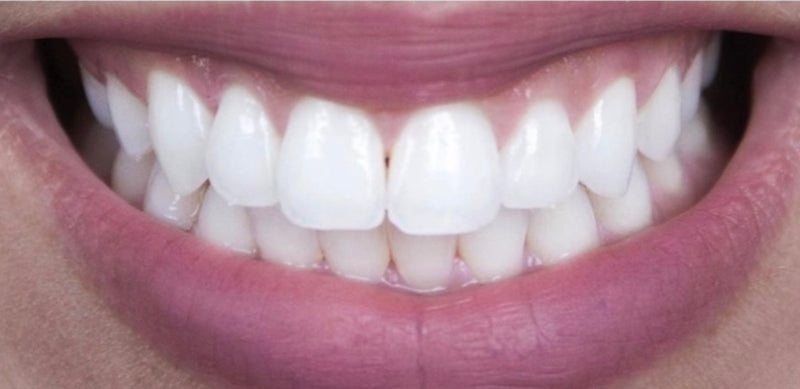 Après — Cliente vérifiée